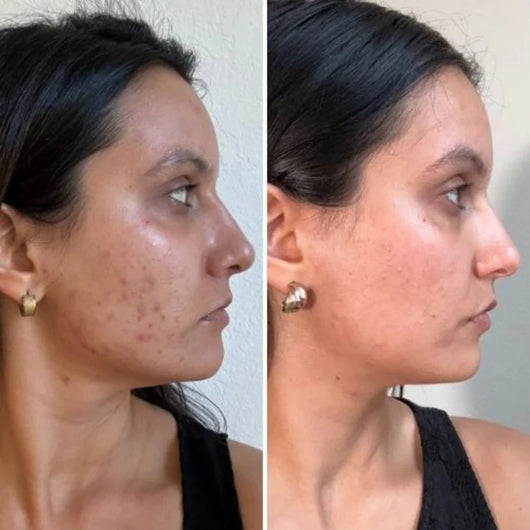Liposomal Glutathione Glow Strips